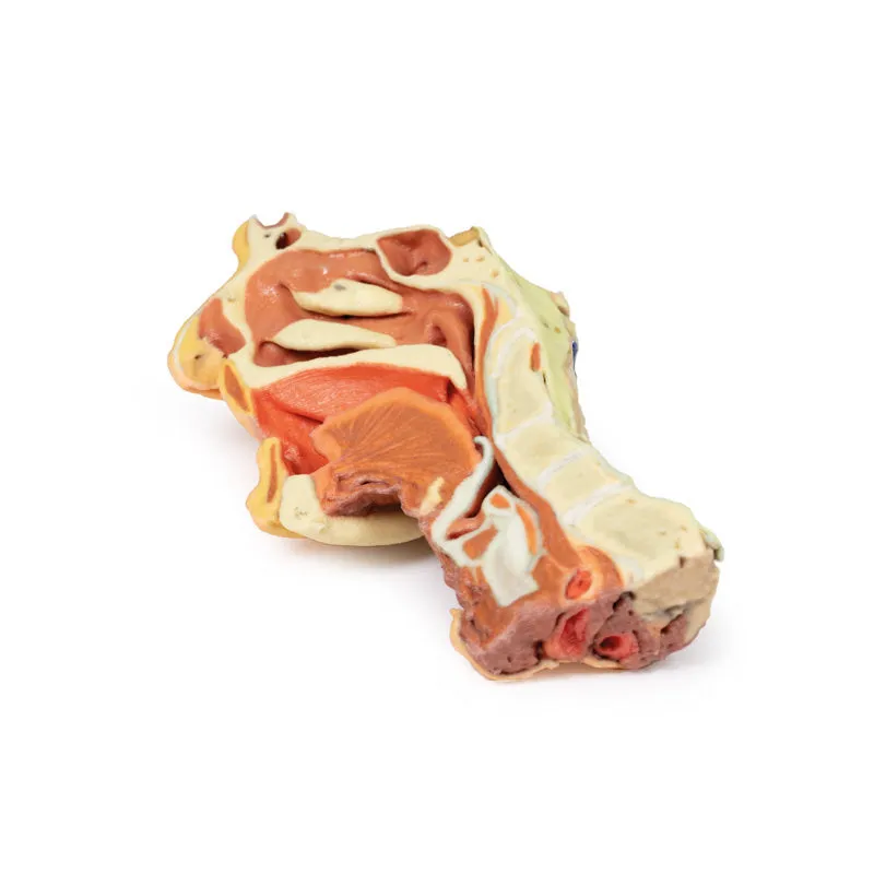 3D Printed Deep face- Infratemporal fossa Model
