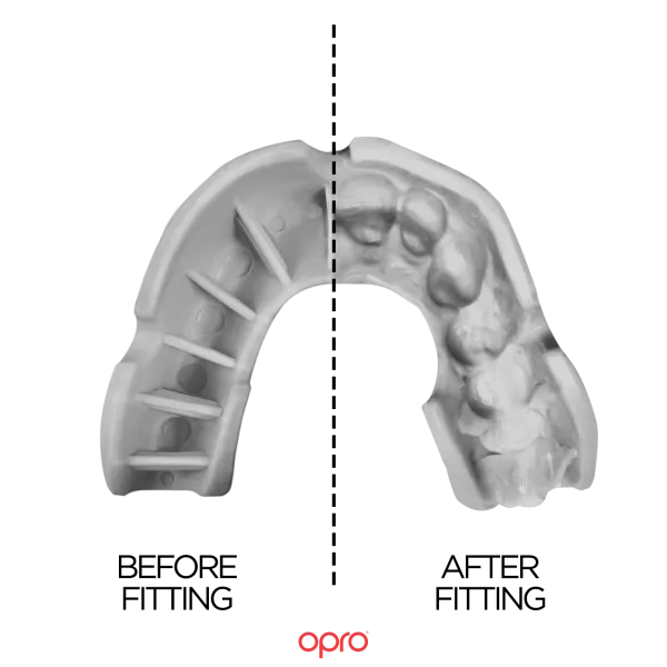 Mouthguard Bronze level White - Junior